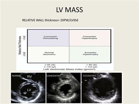 lv mass echo.